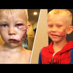Boy Who Saved Sister in Dog Attack Gets Call from Spider-Man