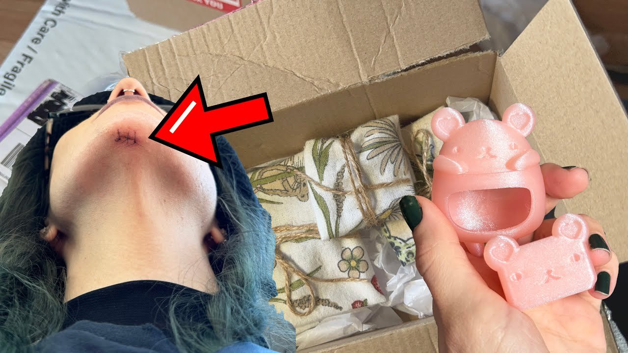 How I SPLIT my CHIN Open + HUGE PO Unboxing (Jumping Spider Supplies, plushies, crystals and MORE!)